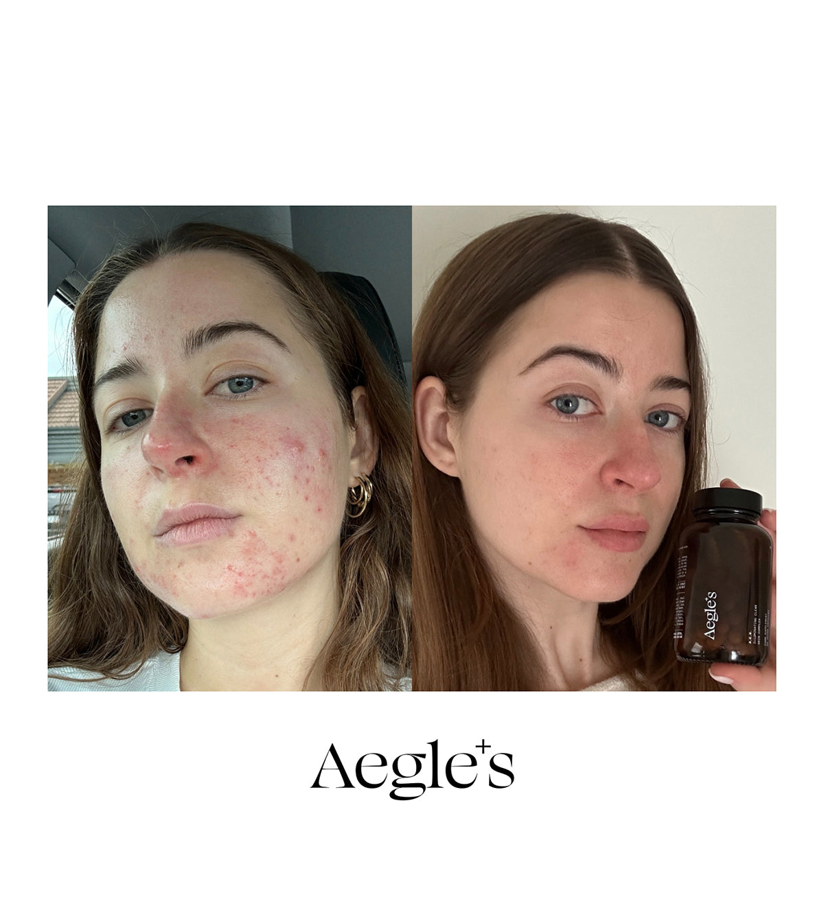 Clear Skin Complex